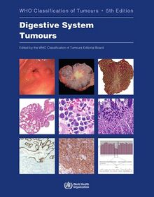 WHO Digestive System Tumours blue book.jpg